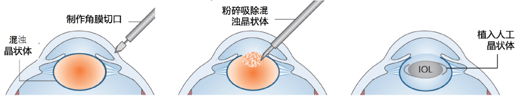 1740732544559161.png b3d8ad1a-37ba-4807-b4c7-fdf7a2d463d5.png